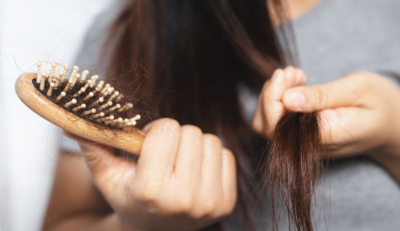 O combate a queda de cabelo